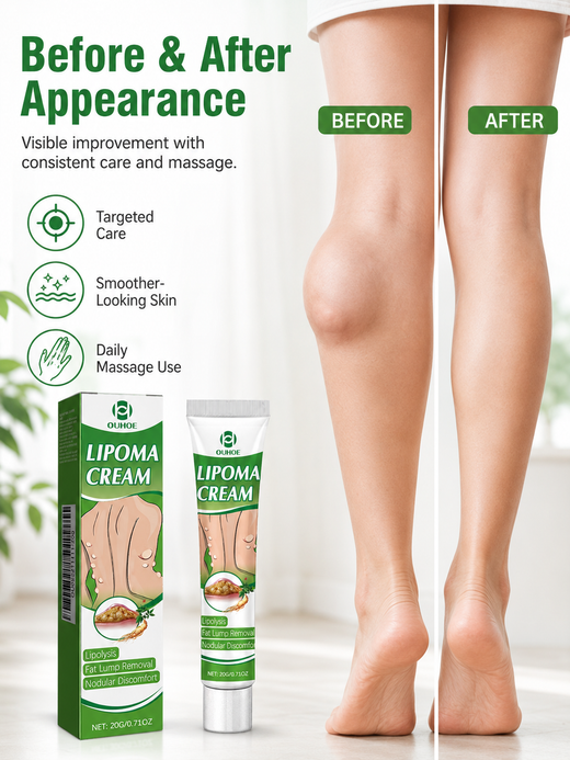 Lipoma Cream — Lipolysis Fat Lump Removal & Nodular Relief