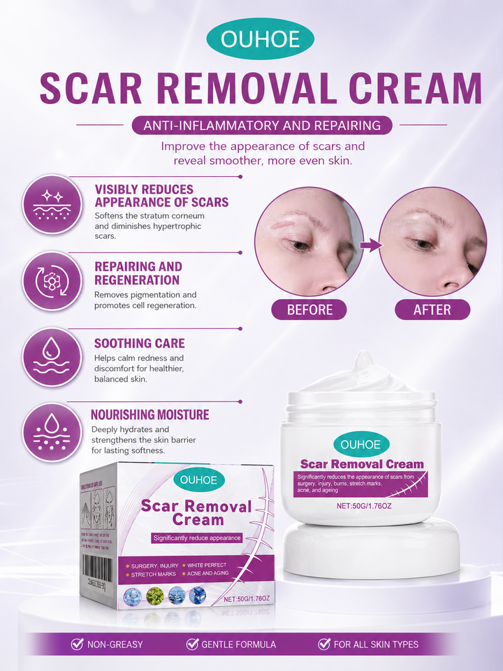 OUHOE Scar Removal Cream 50g — Face & Body Treatment