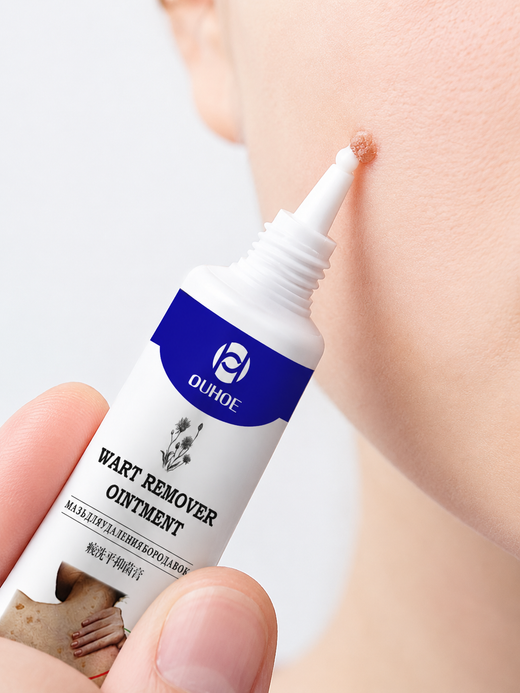 Wart Remover Ointment — Safe Removal of Warts, Skin Tags