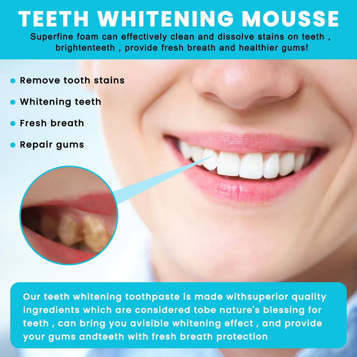 Teeth Whitening Mousse for Stains and Fresh Breath Care