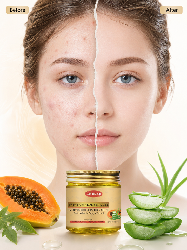 Papaya Aloe Vera Gel — Oil Control Moisturiser for Oily Skin