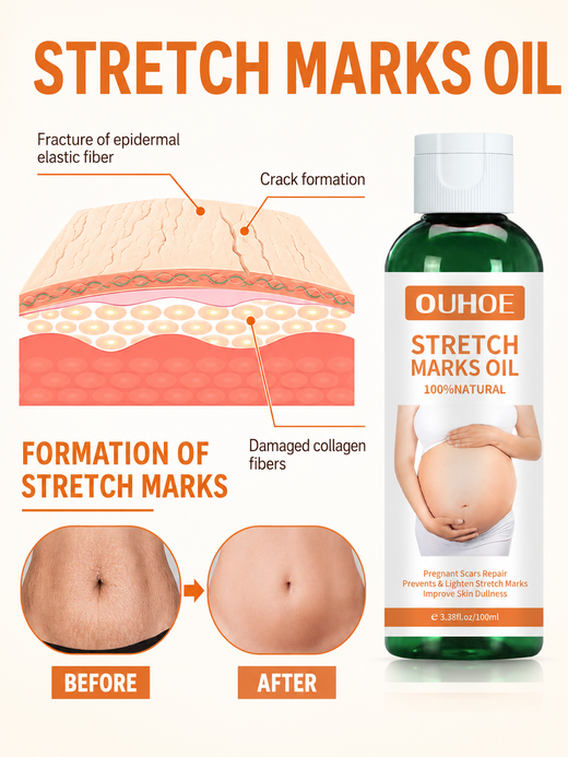 Pregnancy Massage Oil – Prevent & Lighten Stretch Marks Naturally