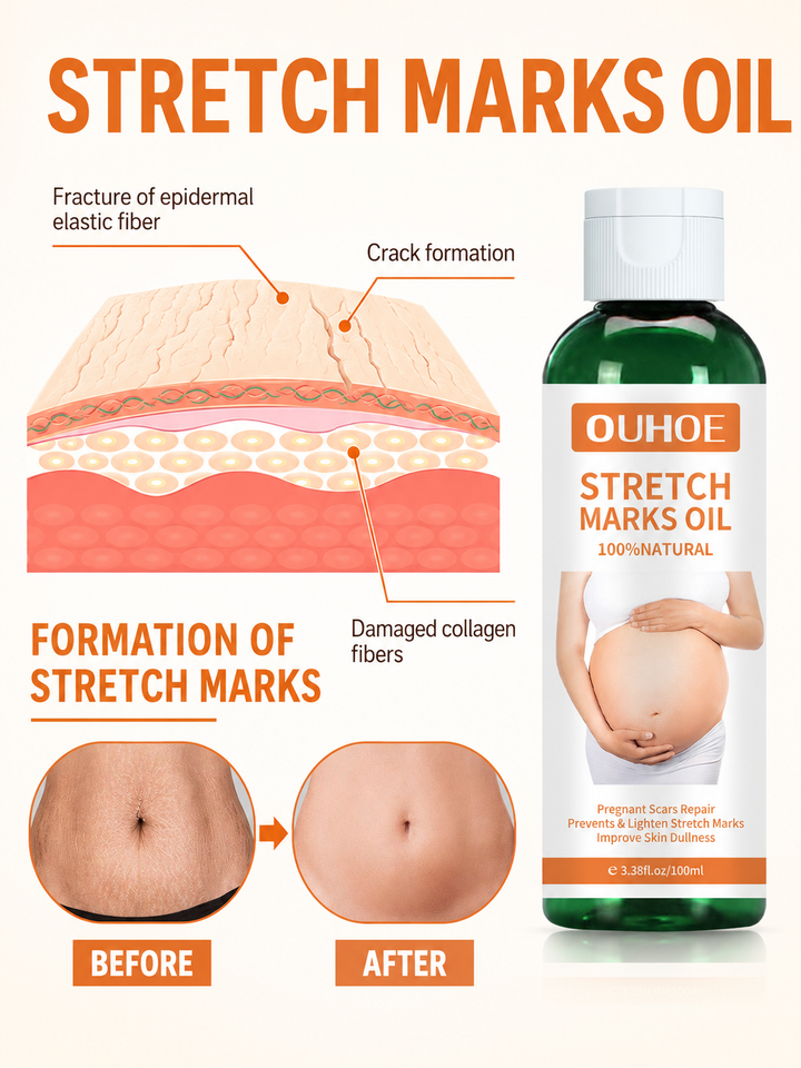 Pregnancy Massage Oil – Prevent & Lighten Stretch Marks Naturally
