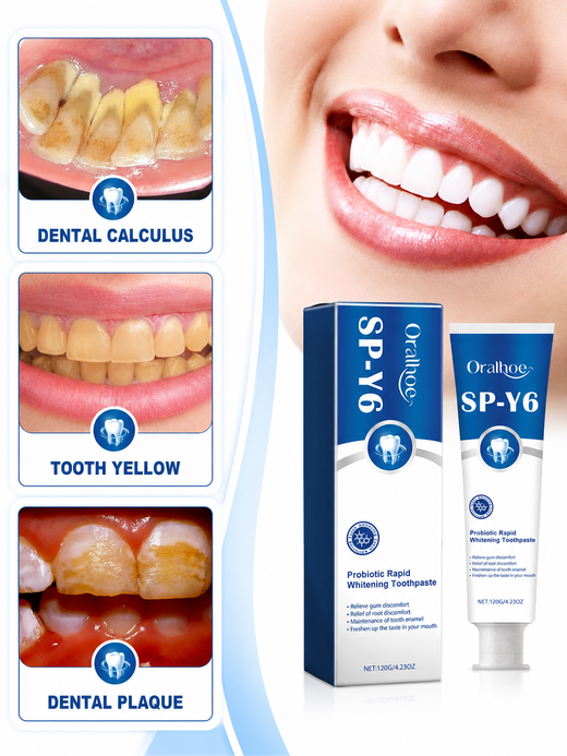Probiotic Whitening Toothpaste — Rapid Whitening & Gum Comfort