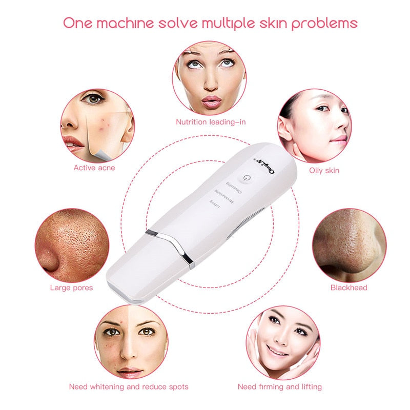 Ultrasonic Facial Scrubber for Blackheads and Pores