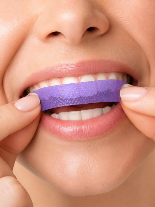Purple Teeth Whitening Strips — Instantly Brighter Smile