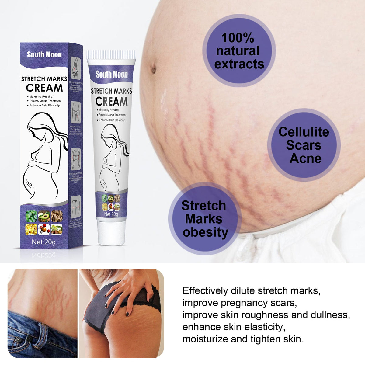 Pregnancy Stretch Mark Cream with Avocado & Vitamin E
