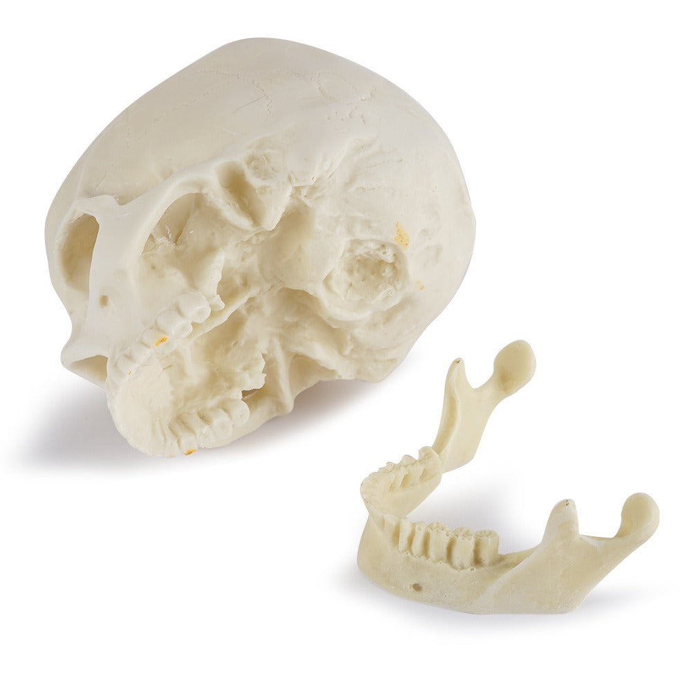 Anatomical Skull Model with Removable Mandible for Study
