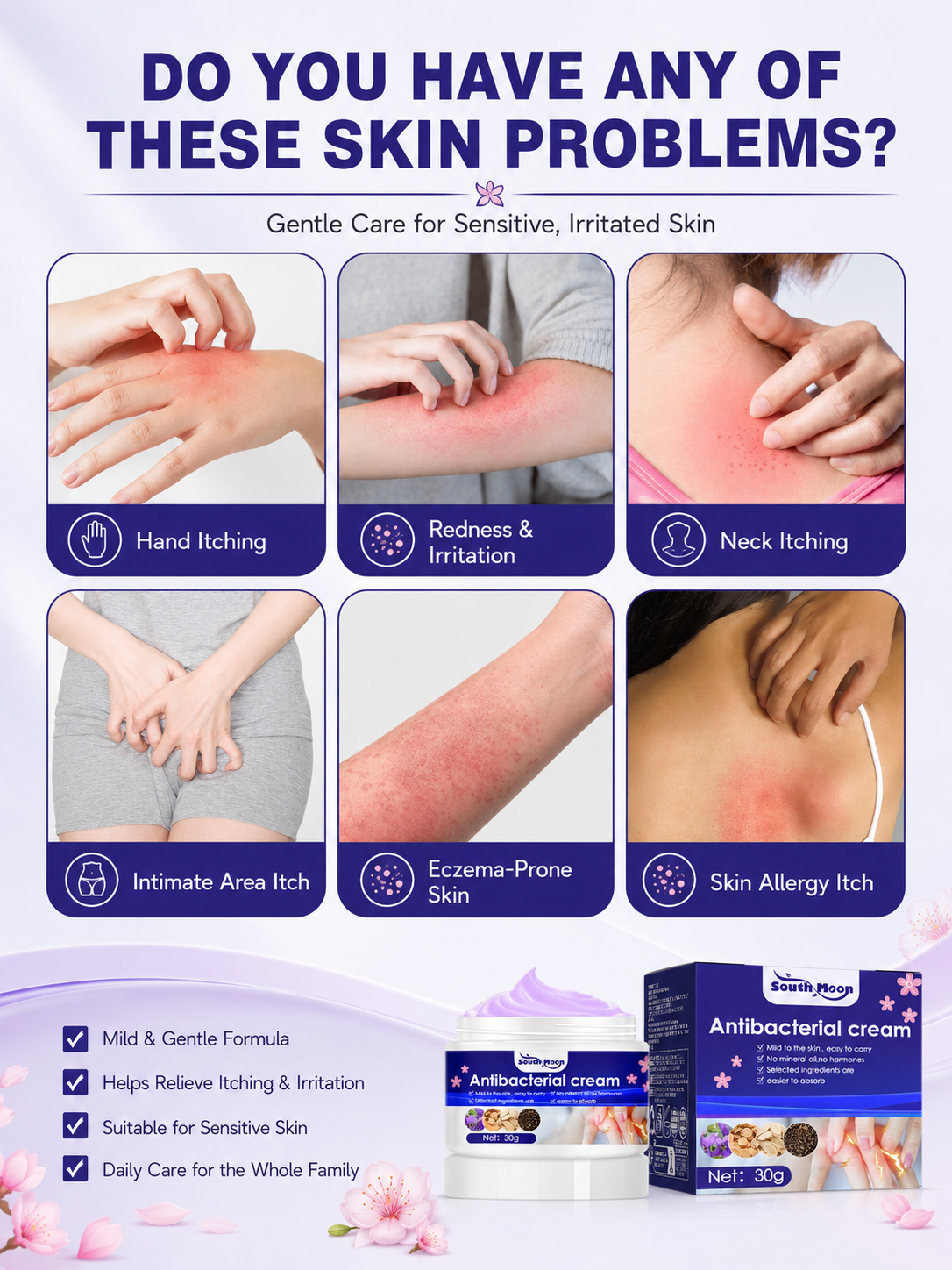 South Moon Antibacterial Cream – Soothing Itch Relief 30g