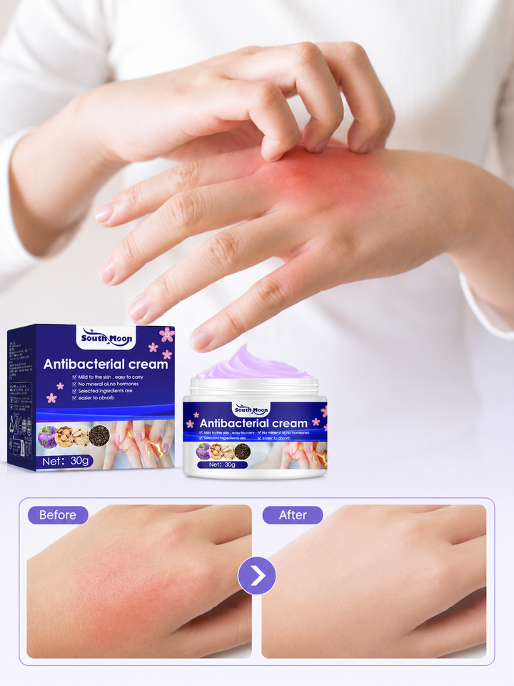 South Moon Antibacterial Cream – Soothing Itch Relief 30g