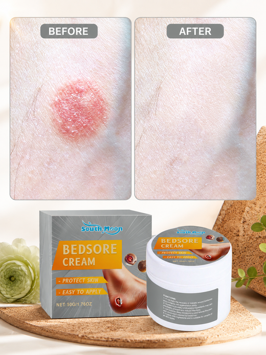 Diabetic Bedsore Cream — Herbal Antibacterial Healing