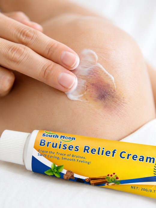 South Moon Bruises Relief Cream — Fade Bruises Faster