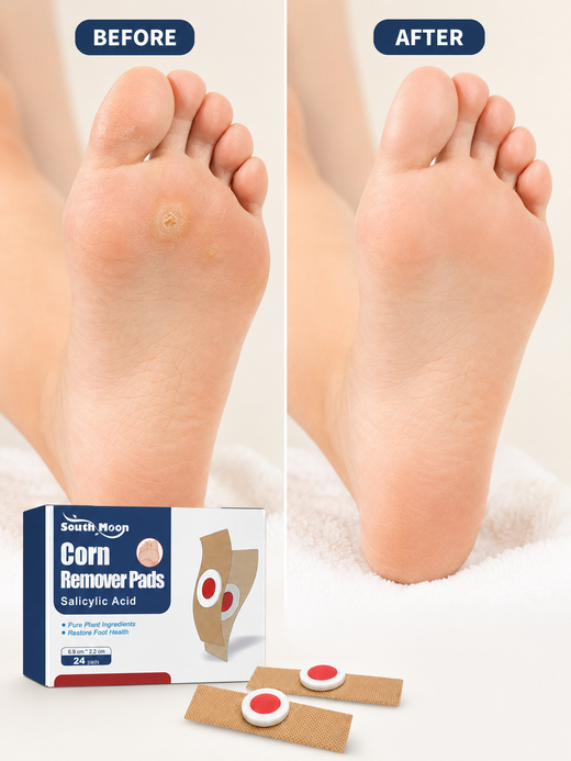 South Moon Corn & Wart Remover Pads — 24 Medicated Pads