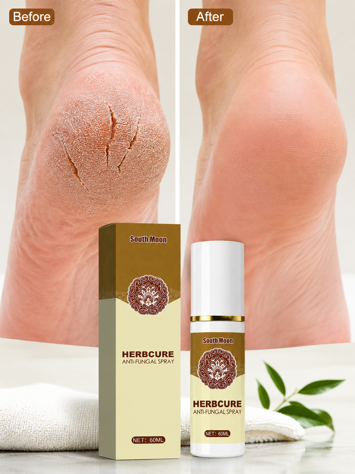 Herbal Anti-Fungal Foot Spray — Dry Cracked Heels Relief