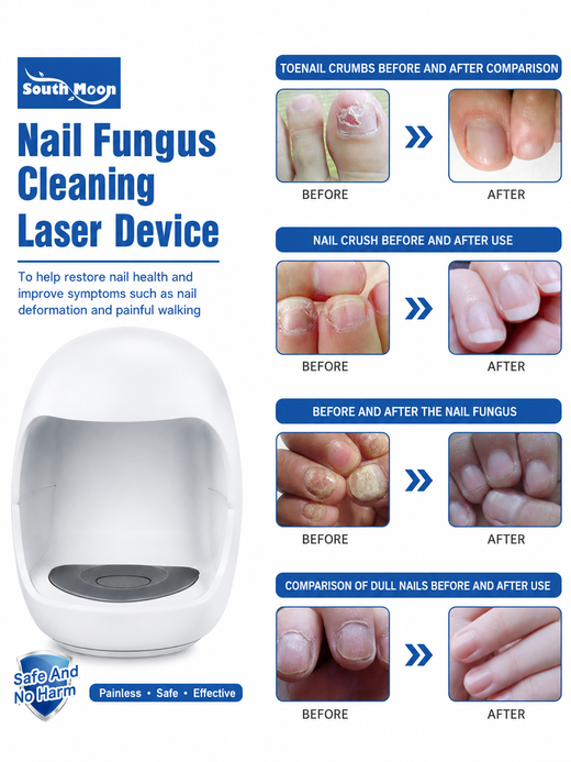 South Moon Phototherapy Nail Fungus Treatment Device