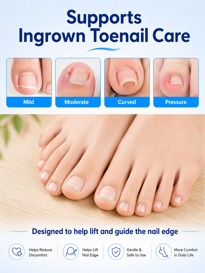Toenail Straightener Patch – Correct Curved Nails at Home