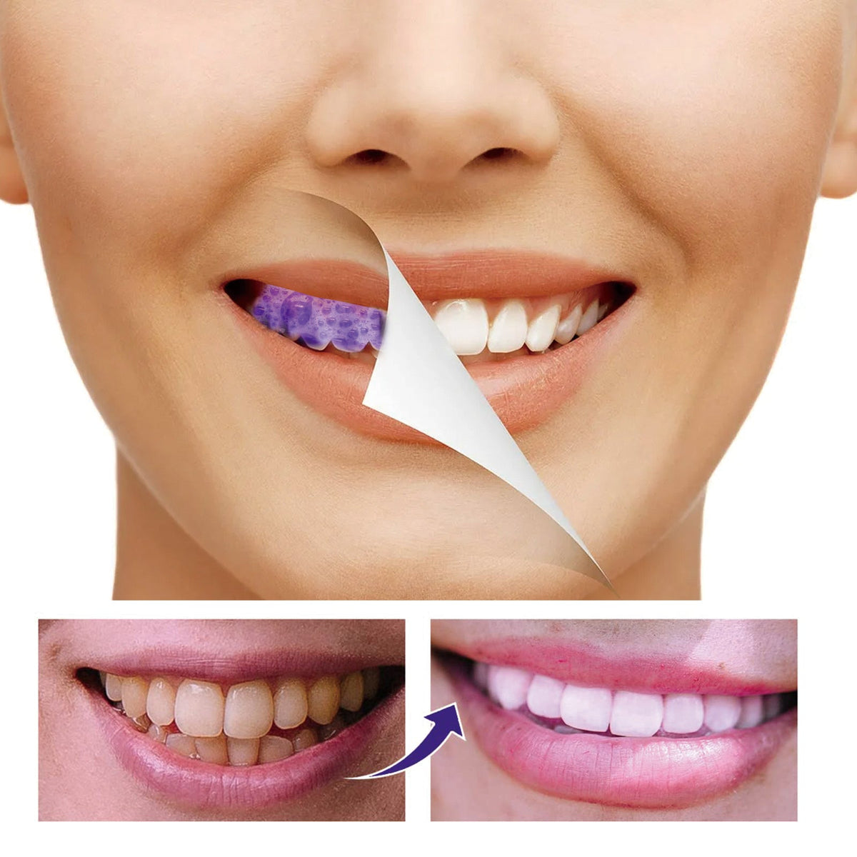 Teeth Whitening Mousse for a Brighter-Looking Smile