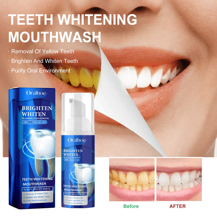Teeth Whitening Mouthwash for Fresh Breath Oral Care