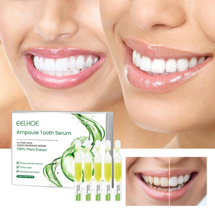 Teeth Whitening Serum for Brighter, Fresher Smiles