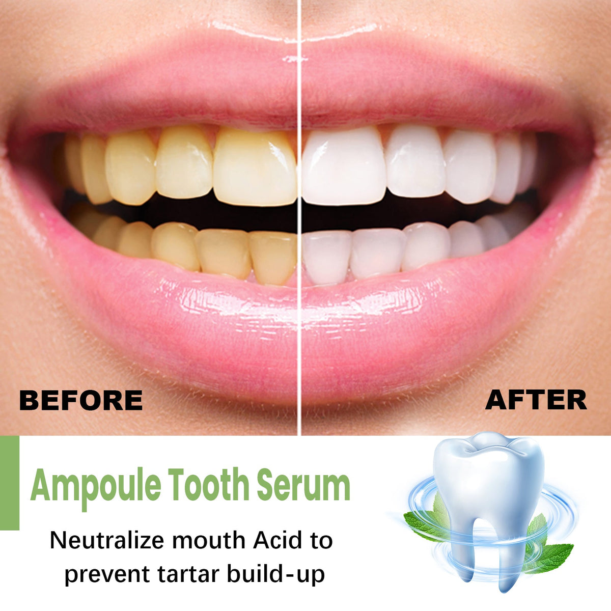 Teeth Whitening Serum for Brighter, Fresher Smiles