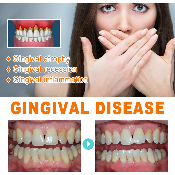 Gum Care Essence Ampoules for Cleaner-Looking Teeth