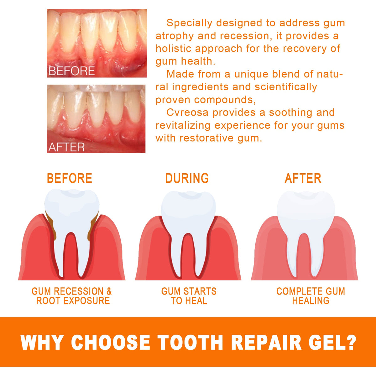 Gum Care Essence Ampoules for Cleaner-Looking Teeth