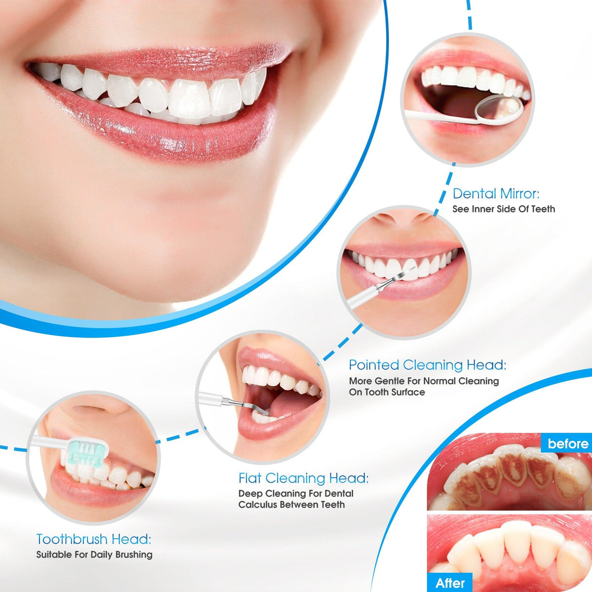 Electric Tooth Scaler Kit: Remove Tartar & Plaque at Home