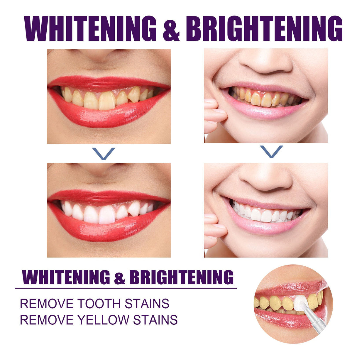 V34 Purple Teeth Whitening Pen for Brighter Smiles