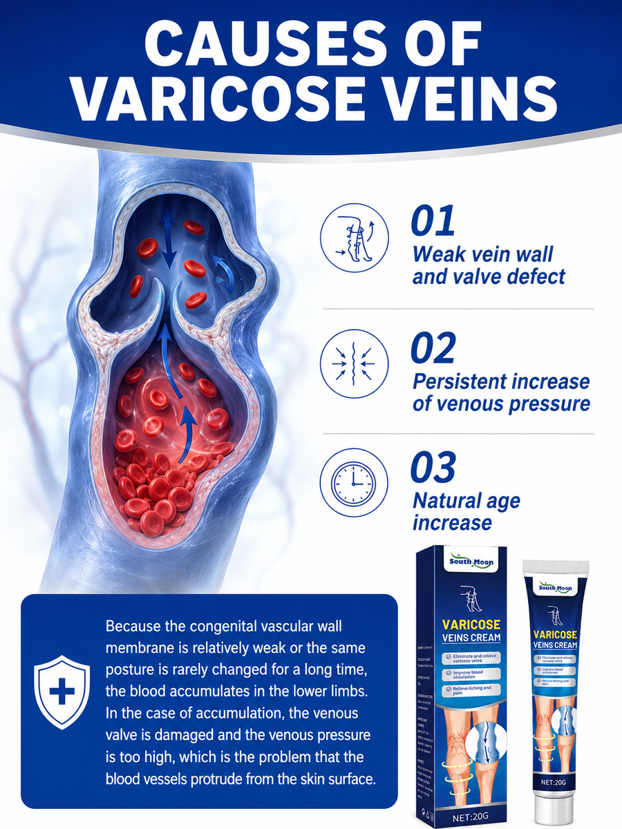 Varicose Vein Cream — Visible Vein Reduction in 2 Weeks