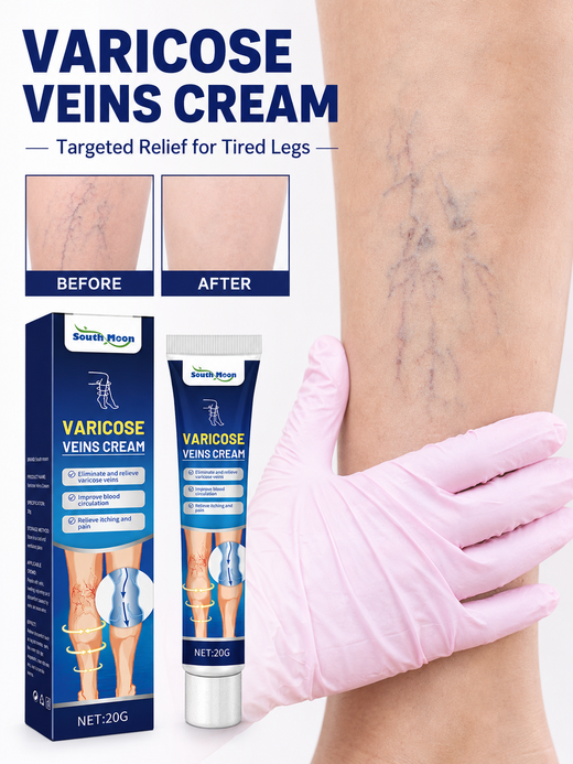 Varicose Vein Cream — Visible Vein Reduction in 2 Weeks