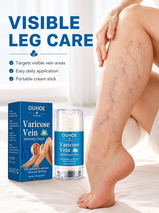 Natural Varicose Vein Cream – Reduces Leg Swelling & Veins