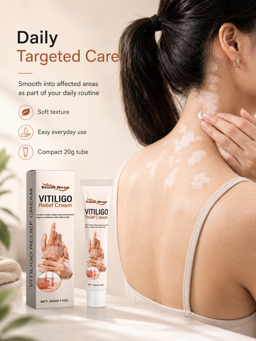 Vitiligo Relief Cream — Visible Improvement & Soothing