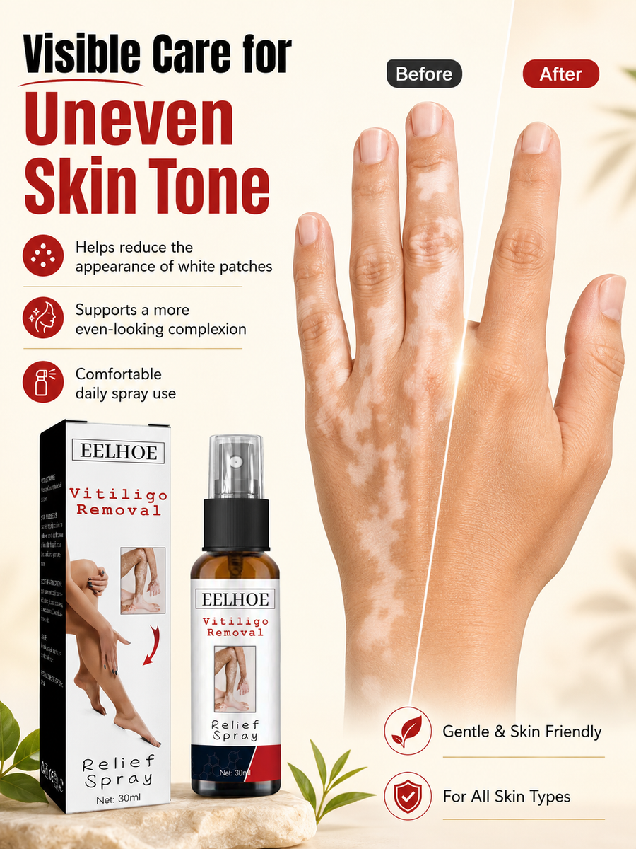Vitiligo Relief Spray — Restore Natural Skin Tone