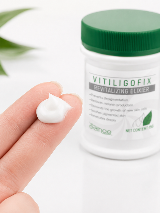Vitiligo Cream — Restore Melanin & Even Skin Tone