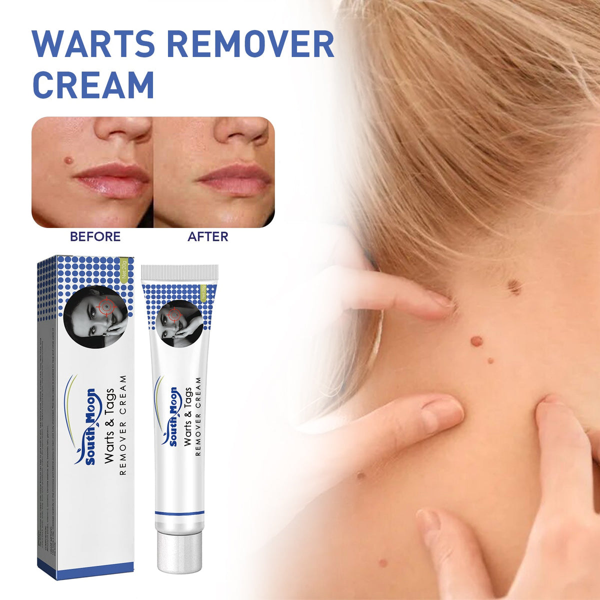 Herbal Wart and Skin Tag Remover Cream with Tea Tree Oil