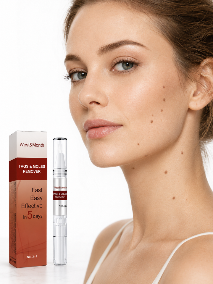 Kew Pen Skin Tag & Wart Remover — Gone in 5 Days