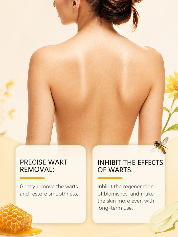 Wiyun Beesvenom Creme — Scar-Free Wart Removal