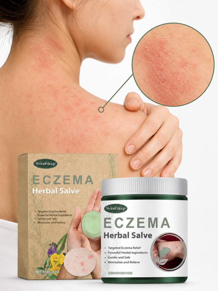 Herbal Eczema Relief Cream — Soothe Redness and Dry Skin
