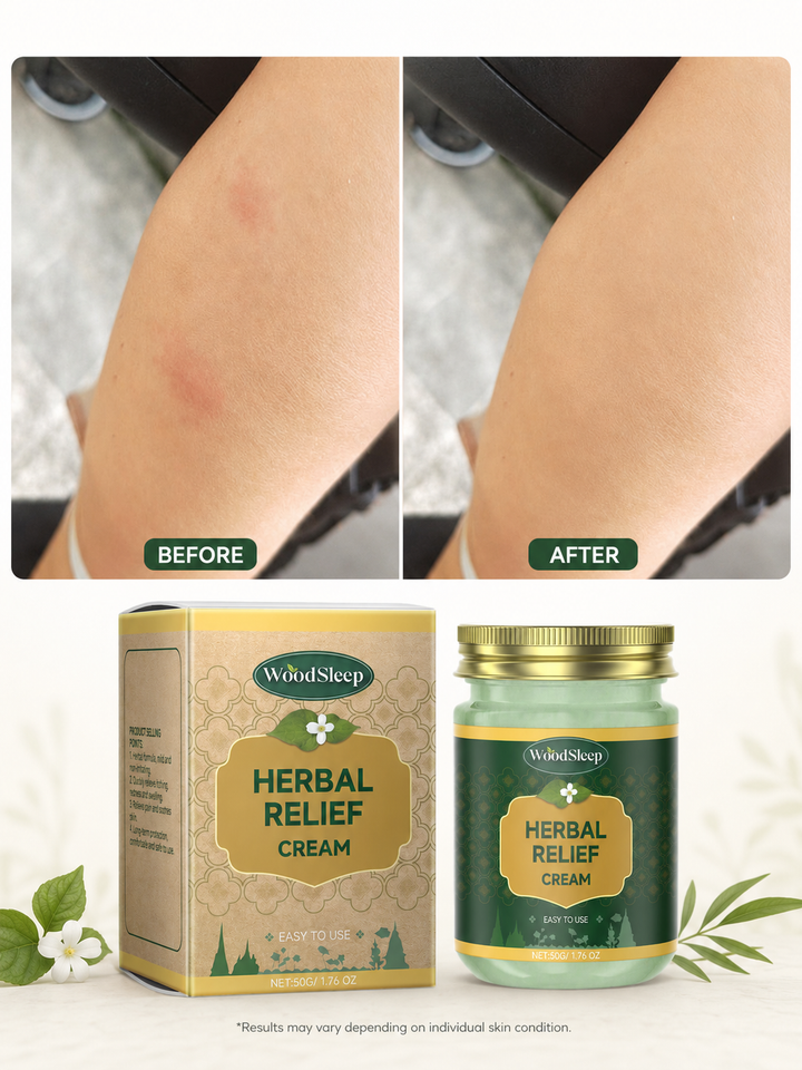 Herbal Anti-Itch Cream — Mosquito Bite Relief That Works
