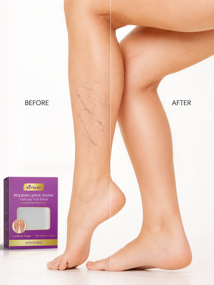 Varicose Vein Leg Patch